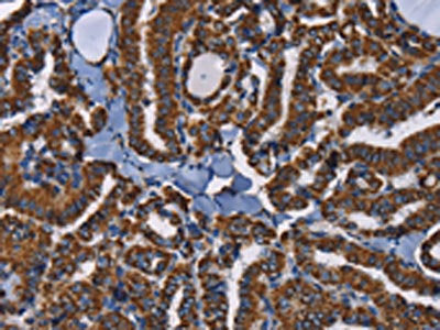 ADRBK2 Antibody
