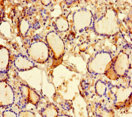 KLHL38 Antibody