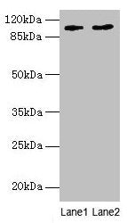 CCDC57 Antibody