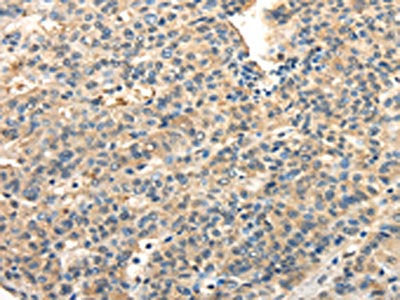 TWIST2 Antibody