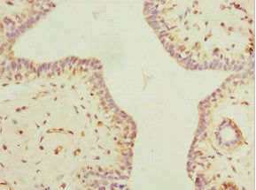 MYLK3 Antibody