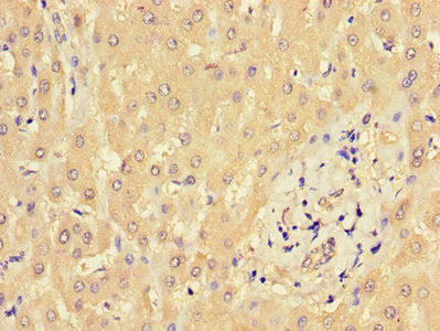 BBS9 Antibody