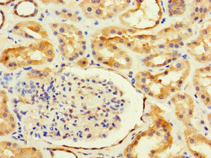 ANKRD55 Antibody