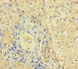 KRT71 Antibody