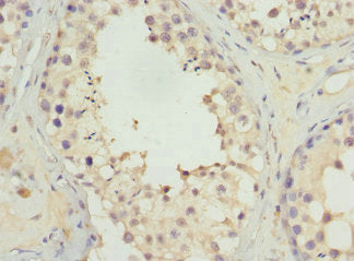 UGT3A2 Antibody
