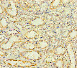 SLC25A35 Antibody
