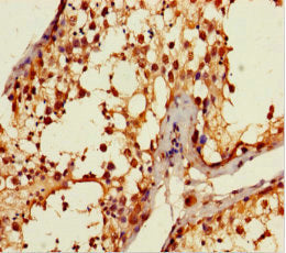 ANKDD1A Antibody