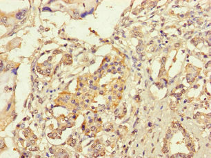 RIC1 Antibody
