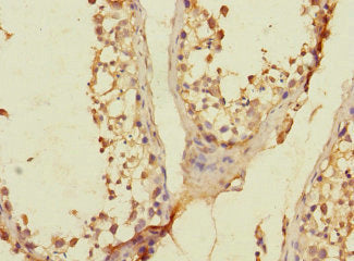 SLC36A3 Antibody