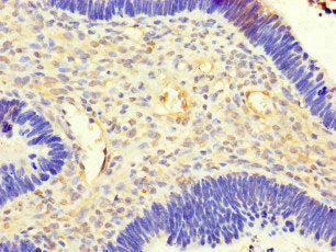 ACSF3 Antibody