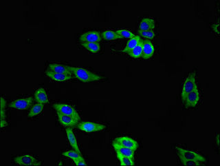 TIGIT Antibody