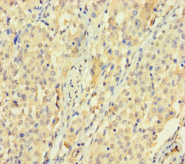 SPATS1 Antibody