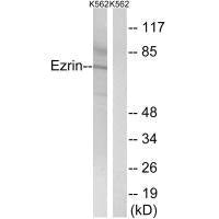 EZR (Ab-478) Antibody