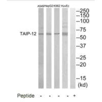 CSRNP2 Antibody