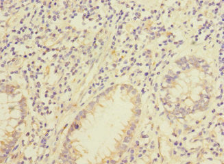 IQCC Antibody