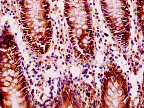 FILIP1L Antibody