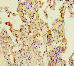 CCDC184 Antibody