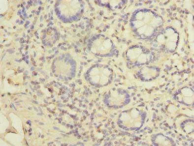 EIPR1 Antibody