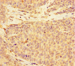 C2CD6 Antibody