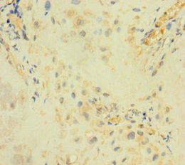 ARSI Antibody