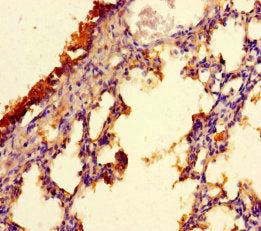 CFAP157 Antibody