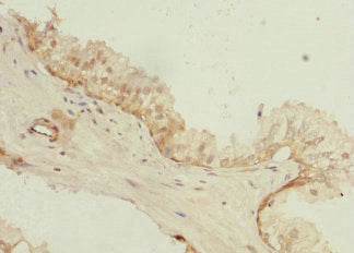 PHLDA2 Antibody
