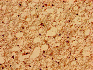 TMEM67 Antibody