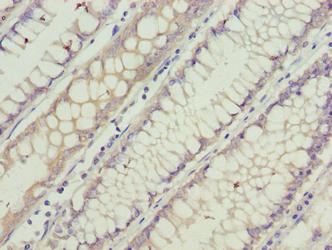GCSAML Antibody