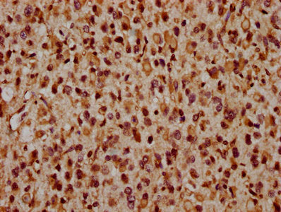 CRB2 Antibody