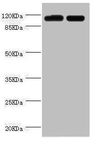 PITRM1 Antibody