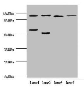 PITRM1 Antibody