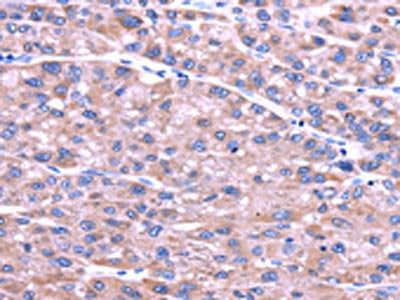 SENP2 Antibody