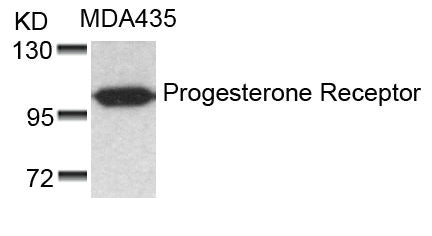 PGR (Ab-190) Antibody