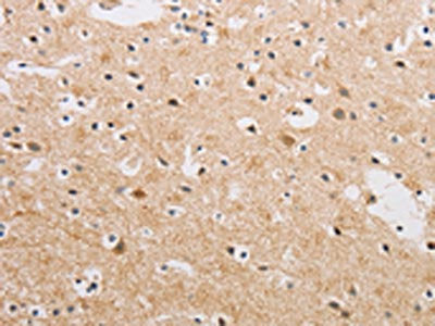 KAT5 Antibody