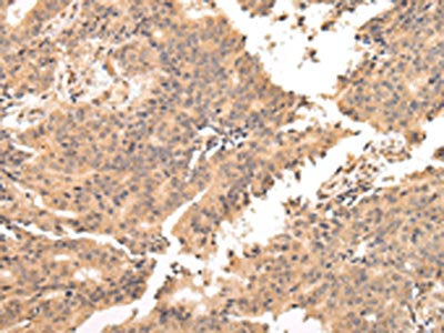 USP45 Antibody