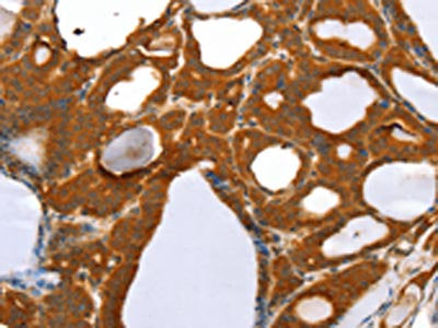 RGS5 Antibody