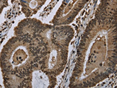 HIST1H2AH Antibody