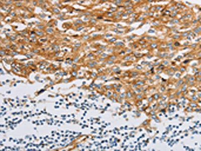 IFITM3 Antibody