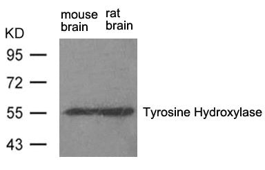 TH (Ab-31) Antibody