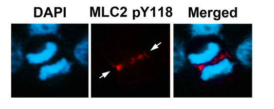 Phospho-MYL9 (Tyr118) Antibody