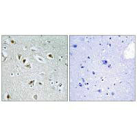 CDK2AP2 Antibody