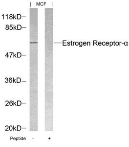 ESR1 (Ab-118) Antibody