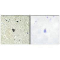CSF1R (Ab-809) Antibody