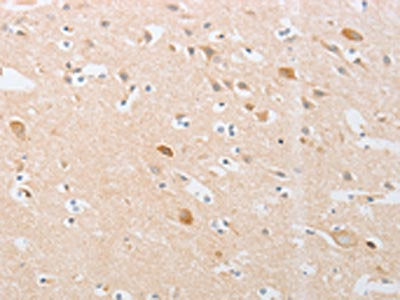 CDKN2AIP Antibody
