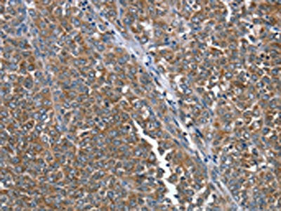PTRH2 Antibody