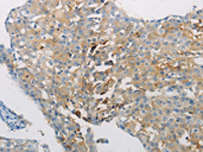 AATK Antibody