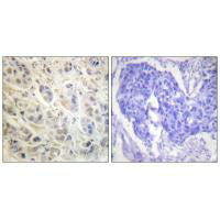 RPS6KA1 (Ab-573) Antibody