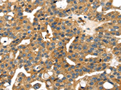 SMYD4 Antibody