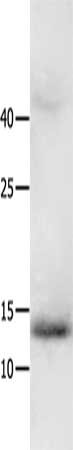HMGA2 Antibody