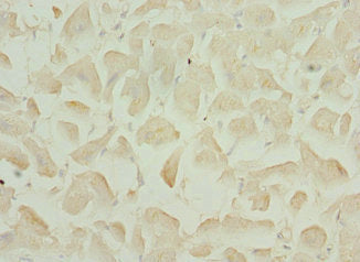 TNNI3K Antibody